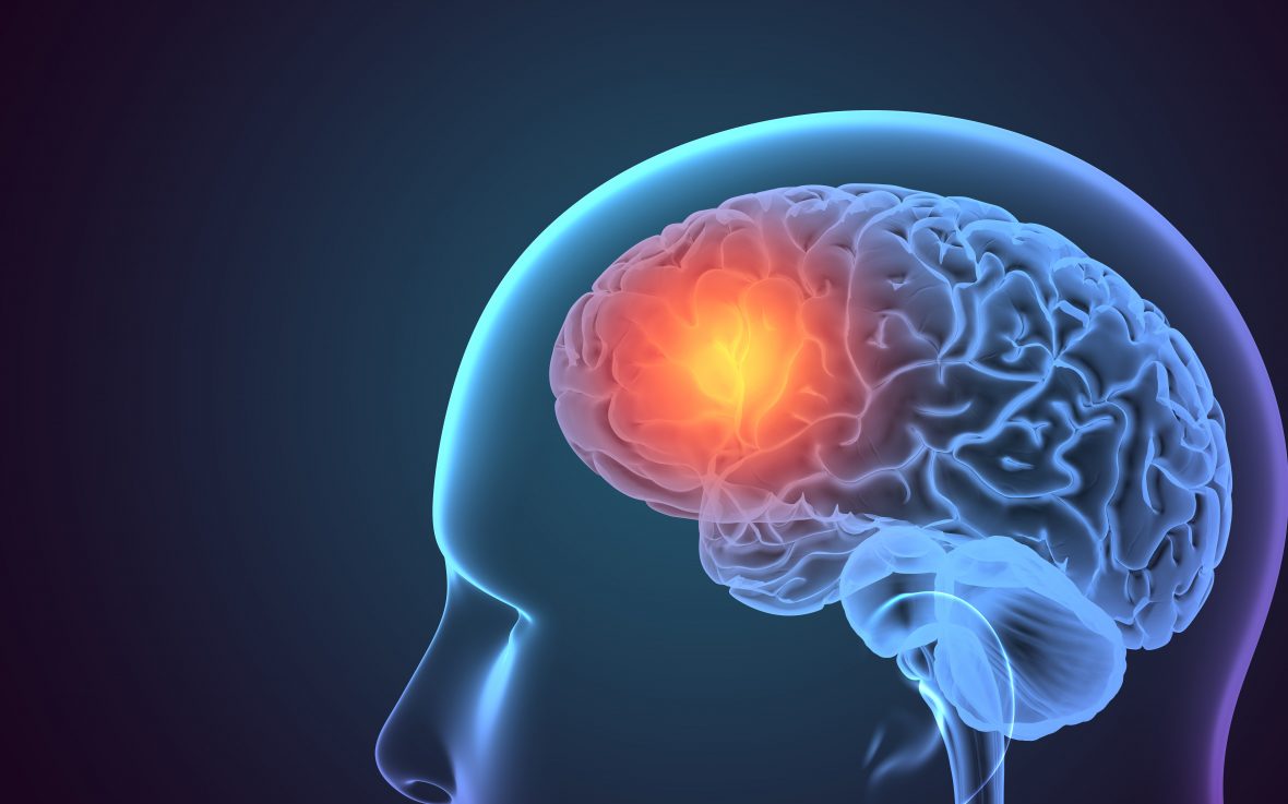 Tratamento para Metástases Cerebrais: Onde estamos?