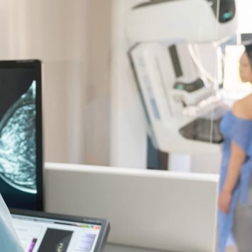A primeira mamografia deve ser realizada aos 40, 45 ou 50 anos?