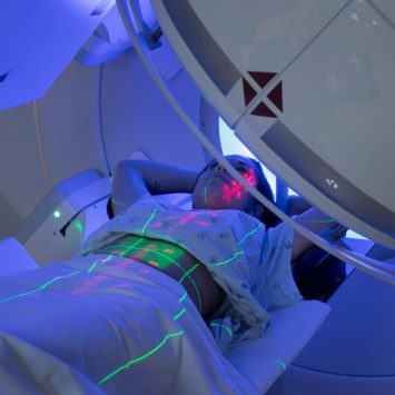 Os efeitos colateriais agudos da Radioterapia