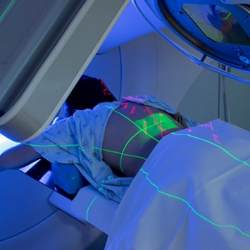 As marcas da Radioterapia